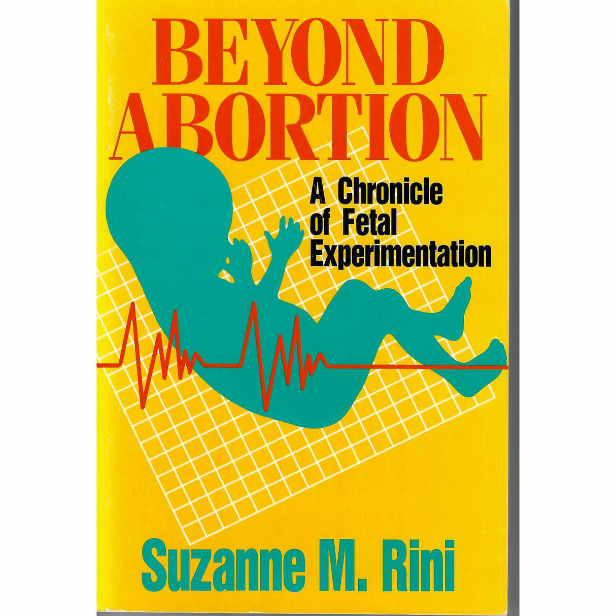 Beyond Abortion: A Chronicle of Fetal Experimentaion